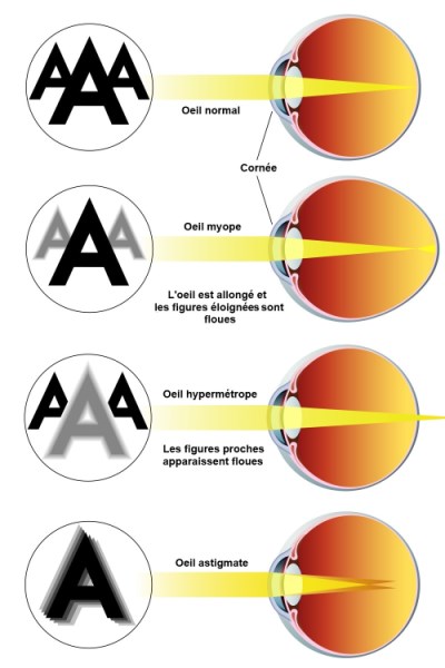 défauts visuels